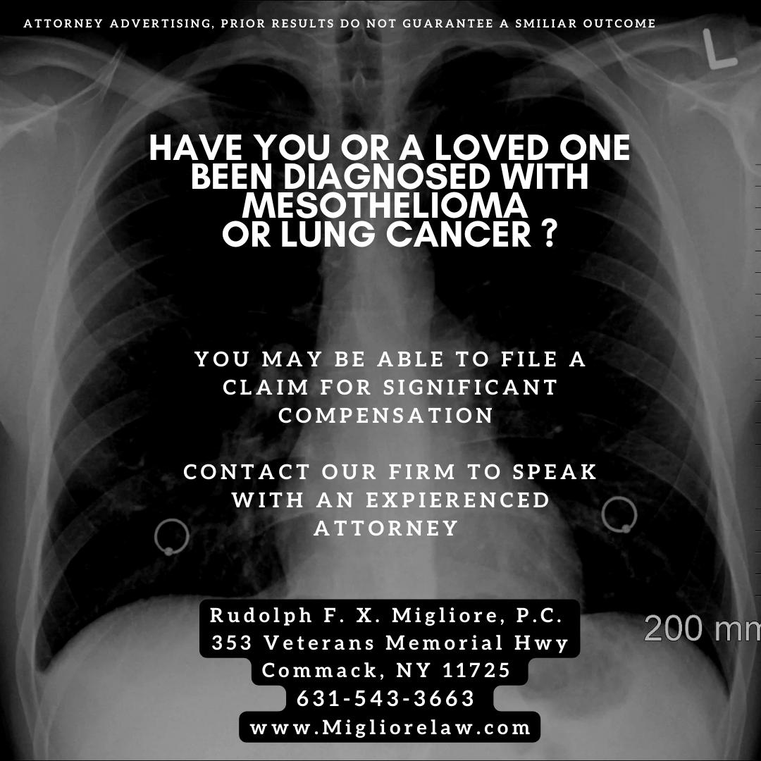 Rudolph F. X. Migliore asbestos mesothelioma lung cancer attorney advertisement